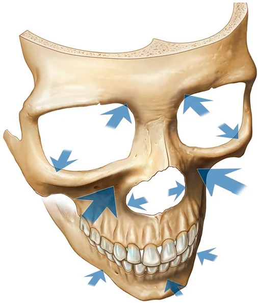 photo of front of skull with blue arrows all around pointing to different areas