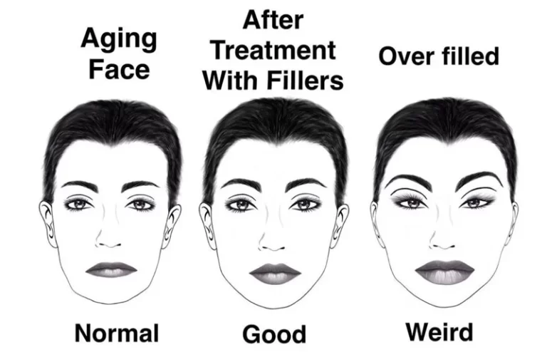 diagram of a filler scale