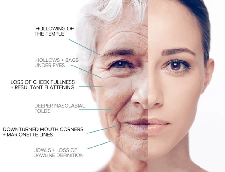 side by side of older woman and younger woman with description of each aging factors