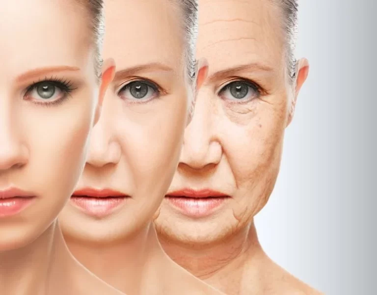 photo of three women indicating age process and wrinkles