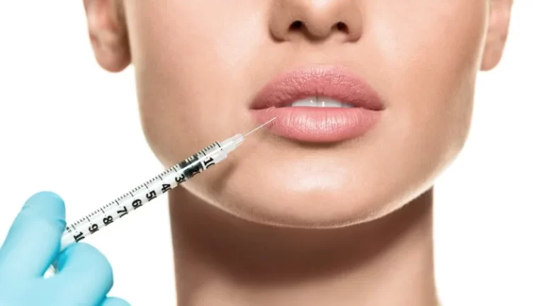 woman getting lip injection
