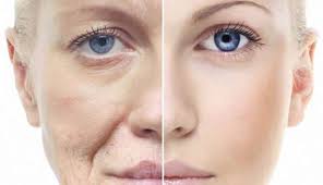 anti-aging