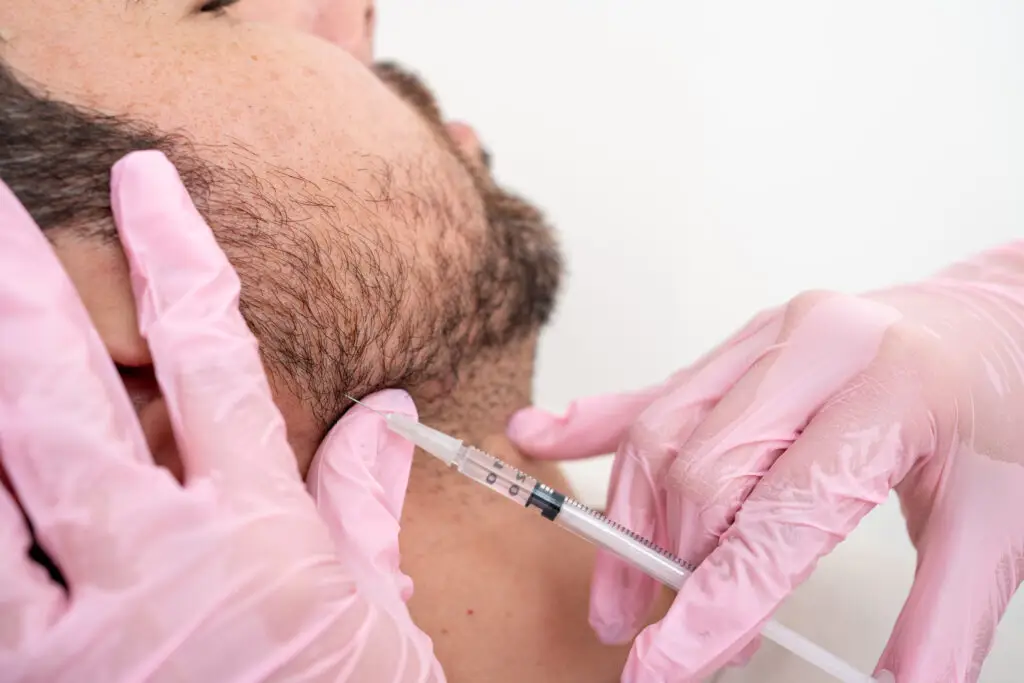 man gets jawline filler in miami beach