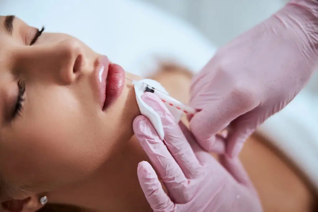 lip filler injection technique miami beach