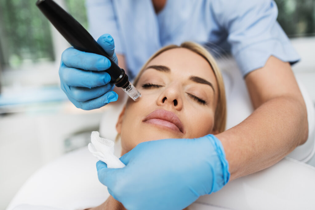 microneedling collagen induction facial miami beach