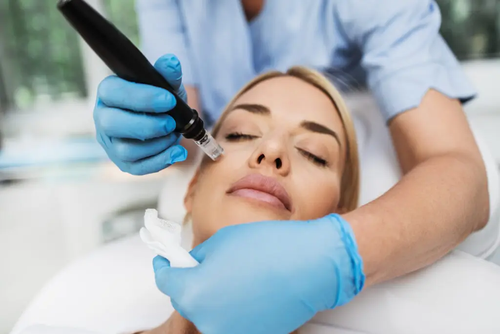 microneedling collagen induction facial miami beach