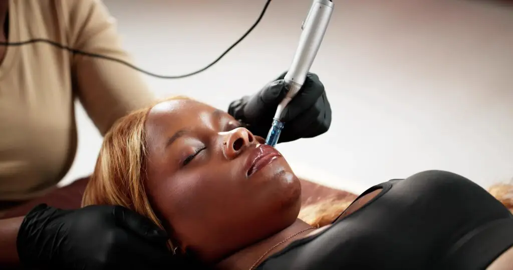 microneedling treatment melanin rich skin miami beach