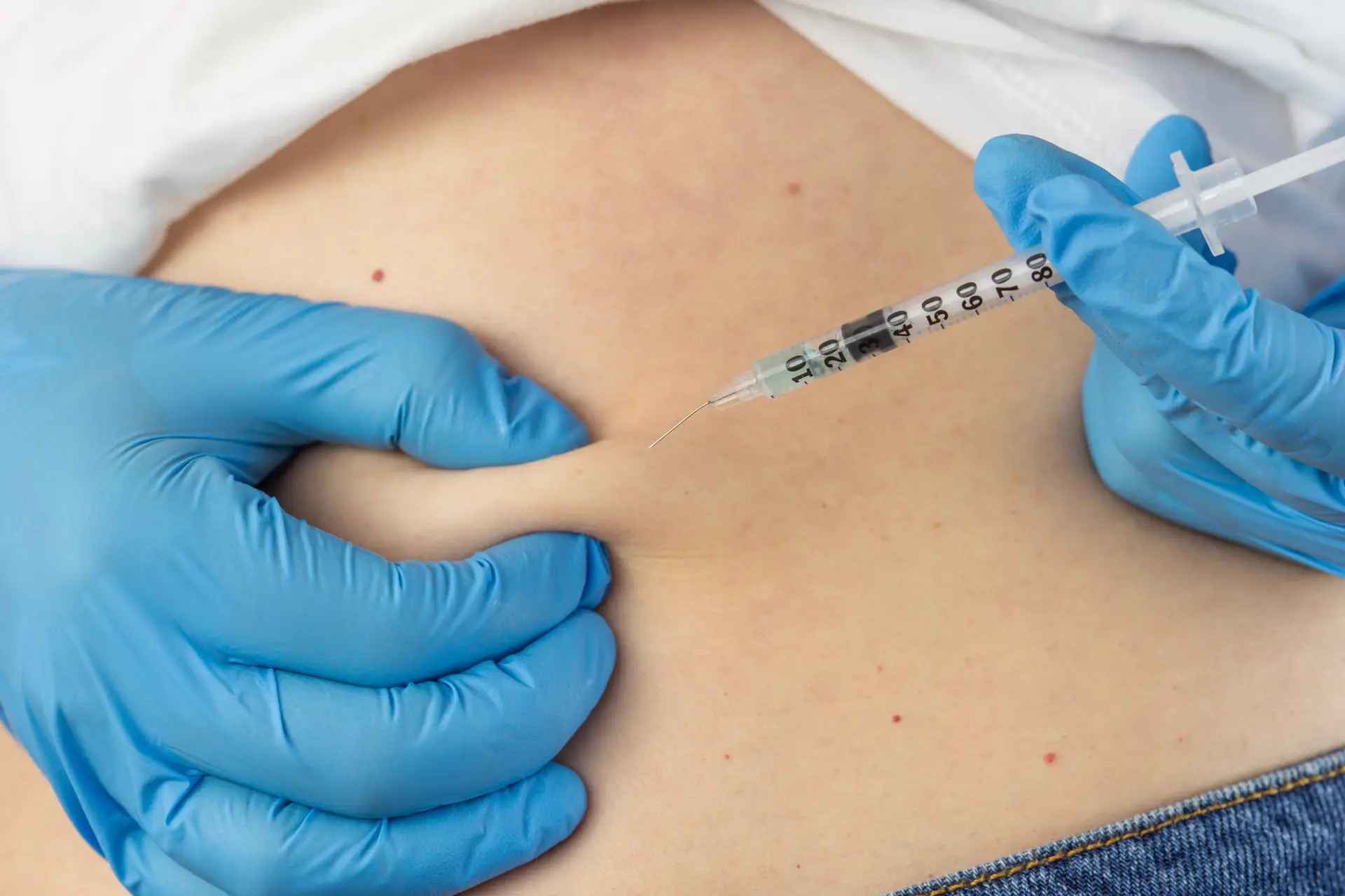 semaglutide abdomen injection technique miami beach