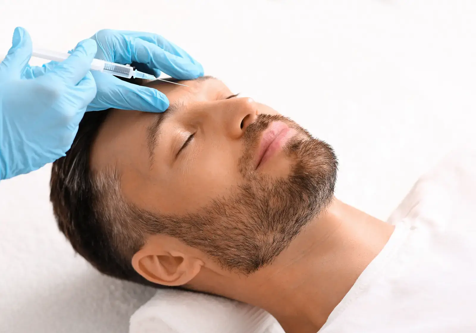 Botox for frown lines in Miami Beach - glabella injection on a male patient, dosed for stronger frown muscles