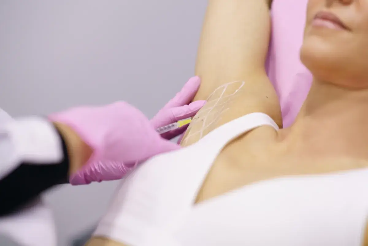 Underarm Botox injection for hyperhidrosis at a Miami Beach med spa, performed by a nurse practitioner