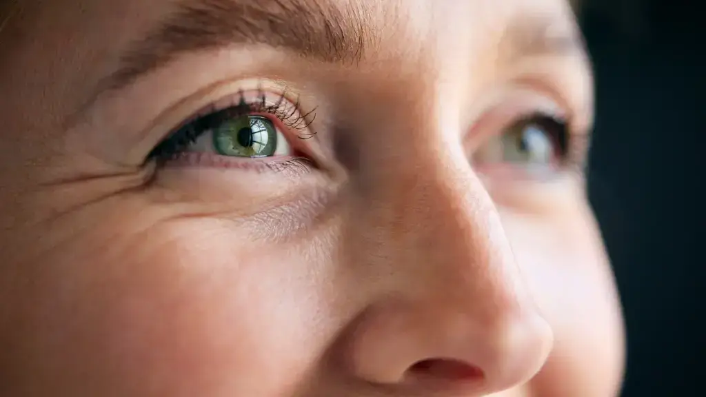 Crow's feet fine lines around a smiling woman's eyes, treated at South Florida Face and Body in Miami Beach