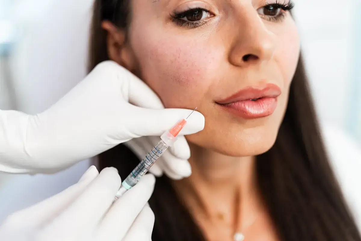 Midface and cheek volume restoration injection in Miami Beach, performed by a nurse practitioner